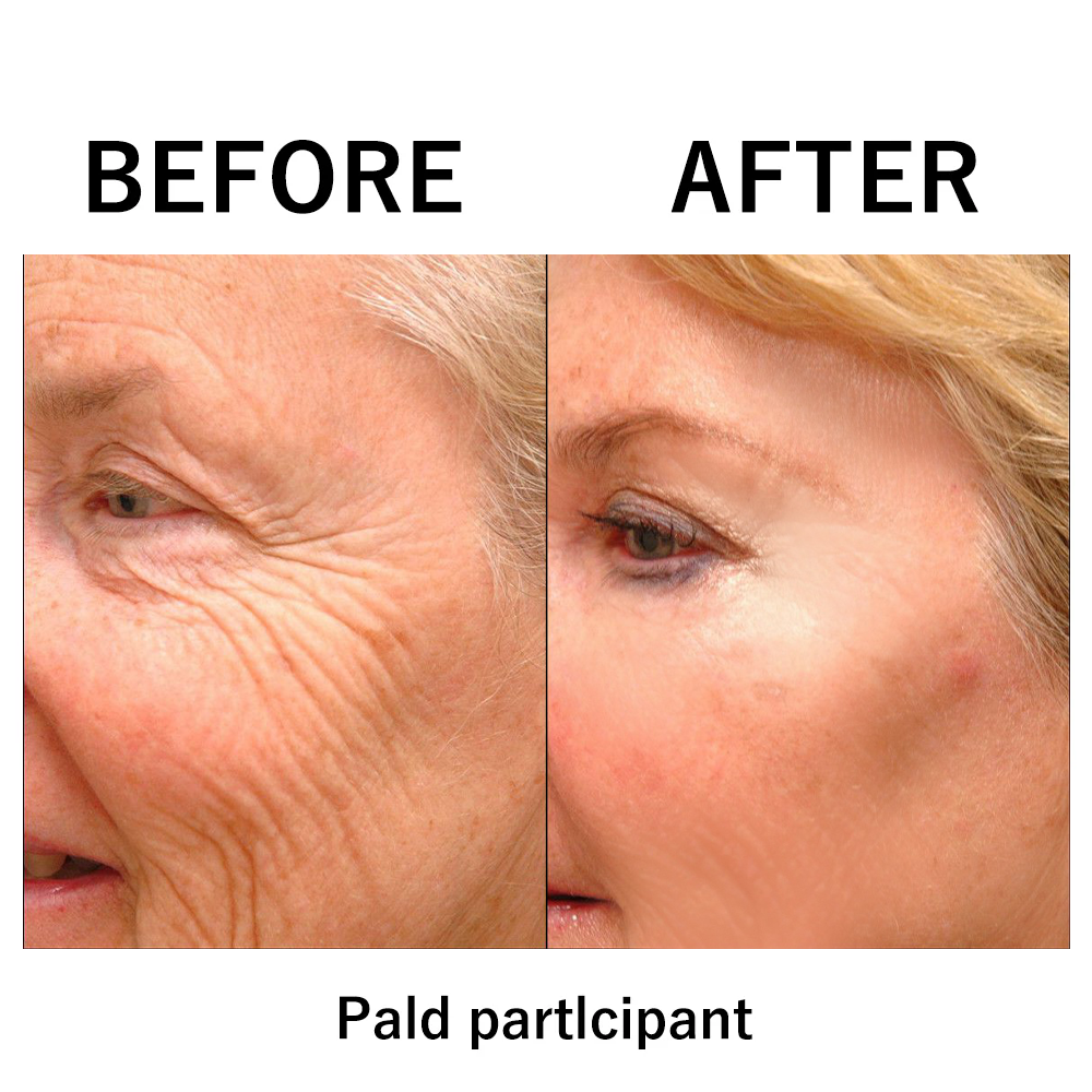 🔥Spring glow Up Sale: 85% OFF🎉 Instant Temporary Face Tightener