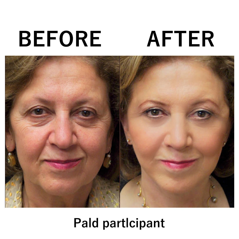 🔥Spring glow Up Sale: 85% OFF🎉 Instant Temporary Face Tightener