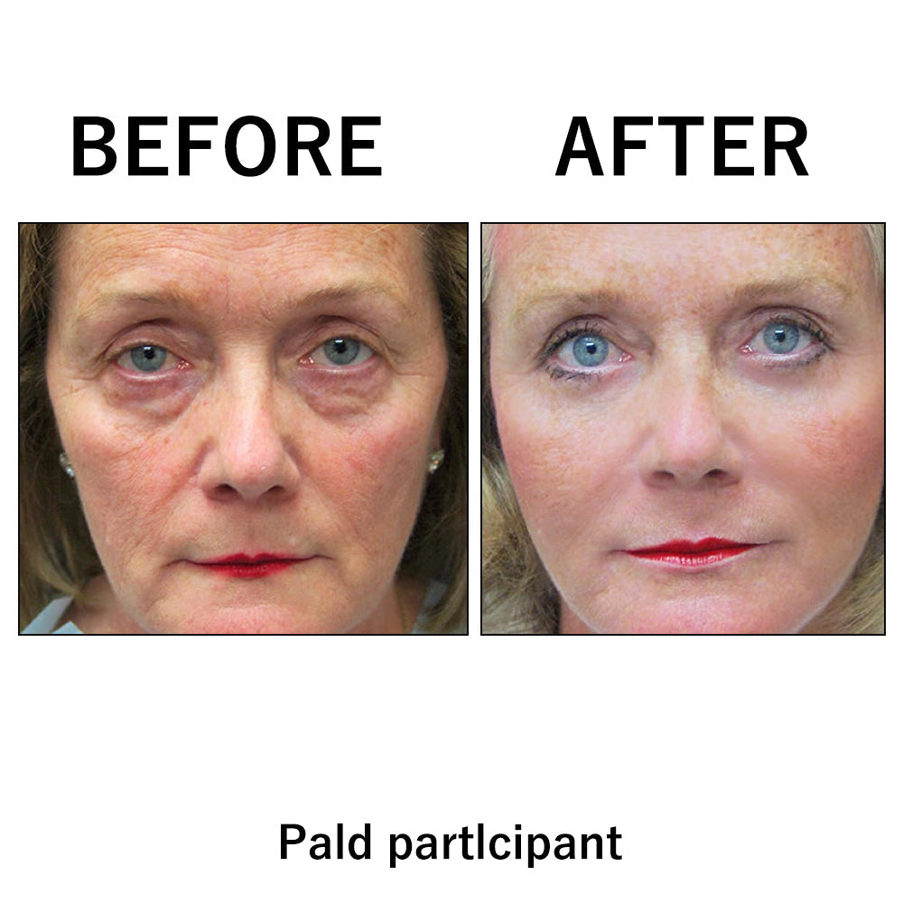 🔥Spring glow Up Sale: 85% OFF🎉 Instant Temporary Face Tightener